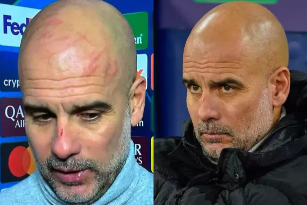 "Guardiola con arañazos tras empate dramático."